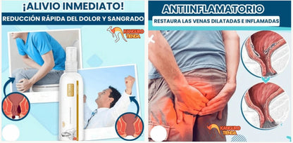 GEL Anti-Hemorroides DICTAMNI - ALIVIO INMEDIATO