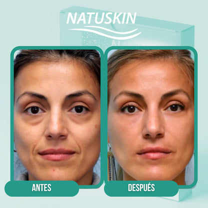 Parches Colagenos Autodisolvent OJERAS