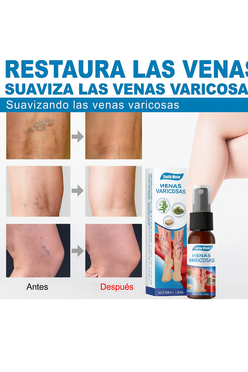 🌿 Aerosol para Várices | Circulación y Alivio Inmediato + 12 Parches Regalo